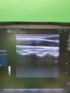 GE Logiq E Portable Ultrasound Machine BT12 (Year: 2012)