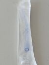 BUSSE Vacuum Curette 8mm  280  Exp.2024-04  (J17) Vacuum Curette 8mm