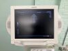 TOSHIBA Nemio XG SSA-580A Diagnostic Ultrasound System