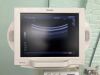 TOSHIBA Nemio XG SSA-580A Diagnostic Ultrasound System