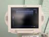 TOSHIBA Nemio XG SSA-580A Diagnostic Ultrasound System