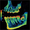 PREXION Eclipse XP77 2D+3D+CBCT Pan 11.3x7.5 FOV with PC, Warranty Dental X-Ray