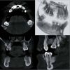 PREXION Eclipse XP77 2D+3D+CBCT Pan 11.3x7.5 FOV with PC, Warranty Dental X-Ray