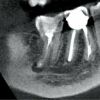 PREXION Eclipse XP77 2D+3D+CBCT Pan 11.3x7.5 FOV with PC, Warranty Dental X-Ray