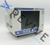 ORIDION Capnostream 20P Monitor