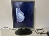 TOTOKU ME315L - MDL2105A X-Ray Monitor
