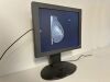 TOTOKU CCL 182 X-Ray Monitor