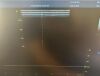 GE L8-18i-RS Ultrasound - Vascular - Small Parts