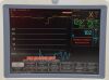 GE Lot of 5  Dash 4000 ECG, SpO2, NBP, Temp, and Printer - 179998 Bedside Monitor