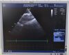 GE HEALTHCARE GE M4S Cardiac Sector Array Ultrasound Transducer 5129041 - 180414 Ultrasound Transducer