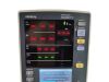 MINDRAY 0998-00-2000-843A Mindray Datascope Accutorr V 0998-00-2000-843A Patient Monitor
