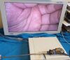 OLYMPUS A5294A Laparoscope
