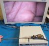 OLYMPUS A5294A Laparoscope