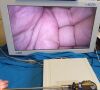 OLYMPUS A5295A Laparoscope
