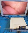 OLYMPUS A22005A Cystoscope