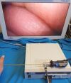 OLYMPUS A22005A Cystoscope
