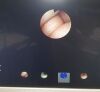 OLYMPUS BF-3C40 Bronchoscope