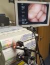 OLYMPUS CF-H260DL Colonoscope
