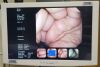 OLYMPUS CF-Q260DL Colonoscope