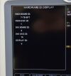 GE Dash 5000 Patient Monitor ECG, SpO2, NBP, Temp, and Printer 2023615-302 - 180997 Monitor