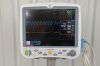 GE Dash 5000 Patient Monitor ECG, SpO2, NBP, Temp, and Printer 2023615-302 - 180997 Monitor