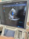 TOSHIBA PST-25BT Ultrasound Transducer