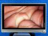 STRYKER 1588 Processor YOM: 2019, L10 Light Source And 1588 Camera Head Laparoscope