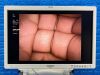 OLYMPUS Visera Elite OTV-S190/CLV-190 With Keyboard, Interface Cable and WA50010 Endoscope