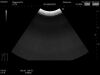 HITACHI EUP-C715 Ultrasound Transducer