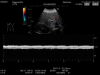 HITACHI EUP-C715 Ultrasound Transducer