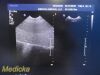 PHILIPS X6-1 Matrix,(Ref 453561247501) *TESTED* ~ Ultrasound Transducer