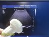 PHILIPS C5-1 (Ref 4553561224464) Broadband Convex Array Ultrasound Transducer