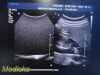 PHILIPS C5-1 (Ref 4553561224464) Broadband Convex Array Ultrasound Transducer