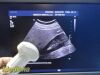 PHILIPS C5-1 (Ref 4553561224464) Broadband Convex Array Ultrasound Transducer