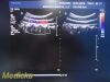 PHILIPS C5-1 (Ref 4553561224464) Broadband Convex Array Ultrasound Transducer