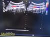 PHILIPS C5-1 REF# 453561224466 Purewave Convex Array Ultrasound Transducer