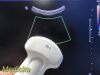 PHILIPS C5-1 Convex Array Ultrasound Transducer