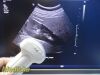 PHILIPS C5-1 Convex Array Ultrasound Transducer