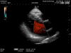 HITACHI S211 Ultrasound Transducer