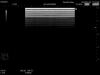 HITACHI EUP-L73S Ultrasound Transducer