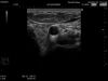 HITACHI EUP-L73S Ultrasound Transducer