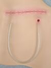 LAERDAL Nursing Anne Mastectomy Chest Skin 325-00650 - 181512 Training Aids