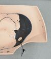 LAERDAL SimMom Gravid Abdomen Normal 377-19150 Training Simulator - 181538 Training Aids