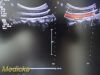 PHILIPS C5-1 Convex Array (Ref # 453561224465) ~ Ultrasound Transducer