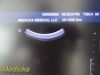 PHILIPS C5-1 Convex Array (Ref # 453561224465) ~ Ultrasound Transducer