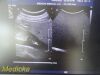 PHILIPS C5-1 Convex Array (Ref # 453561224465) ~ Ultrasound Transducer