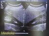PHILIPS C5-1 Convex Array (Ref # 453561224465) ~ Ultrasound Transducer