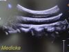 PHILIPS C5-1 Convex Array (Ref # 453561224465) ~ Ultrasound Transducer