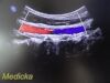 PHILIPS C5-1 Convex Array (Ref # 453561224465) ~ Ultrasound Transducer