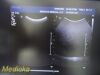 PHILIPS C5-2 Ref 453561224871 Convex Array Ultrasound Transducer